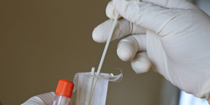 В России перестали действовать нормативы по тестам на COVID-19 - 2023-07-08 20:05:00 - 1