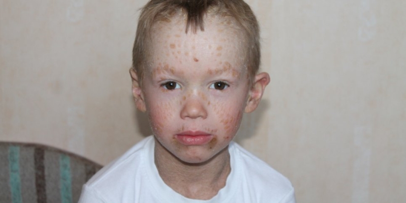 Великолучане собирают деньги на лечение ребенка с редким и тяжелым заболеванием - 2021-06-17 19:00:00 - 1