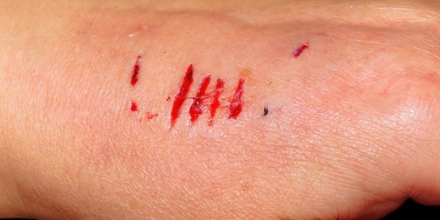 Памятка по предупреждению распространения бешенства - 2021-09-07 10:57:00 - 1