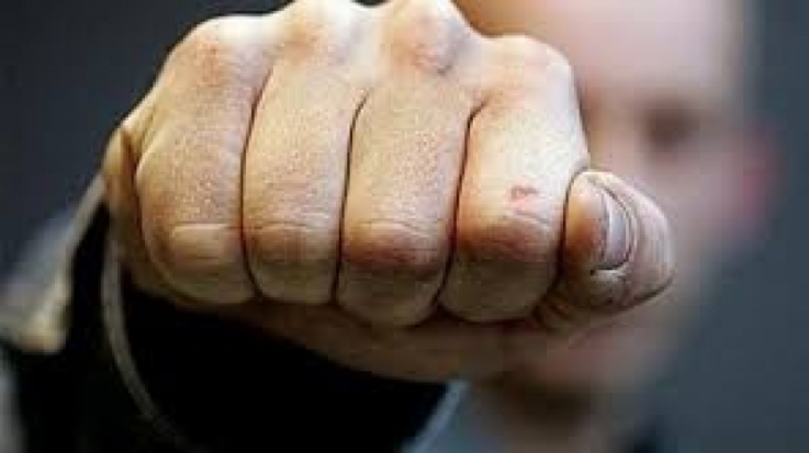 Молодой сожитель избил 55-летнию великолучанку - 2017-02-10 09:36:00 - 1