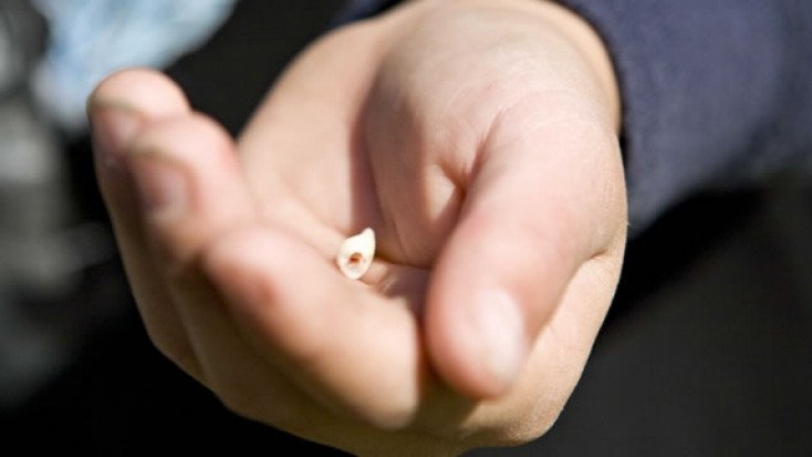 В Великих Луках возле клуба парню выбили зуб - 2016-12-13 09:33:00 - 1