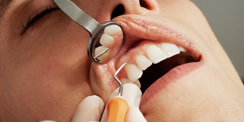 Россиян предупредили о росте цен на лечение зубов - 2026-01-03 17:05:00 - 1