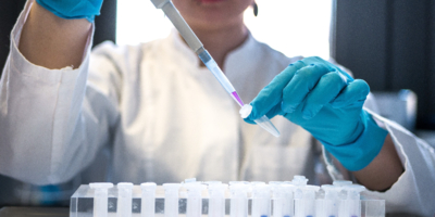 Эксперты проверили холодец разных марок - 2025-12-22 20:05:00 - 1