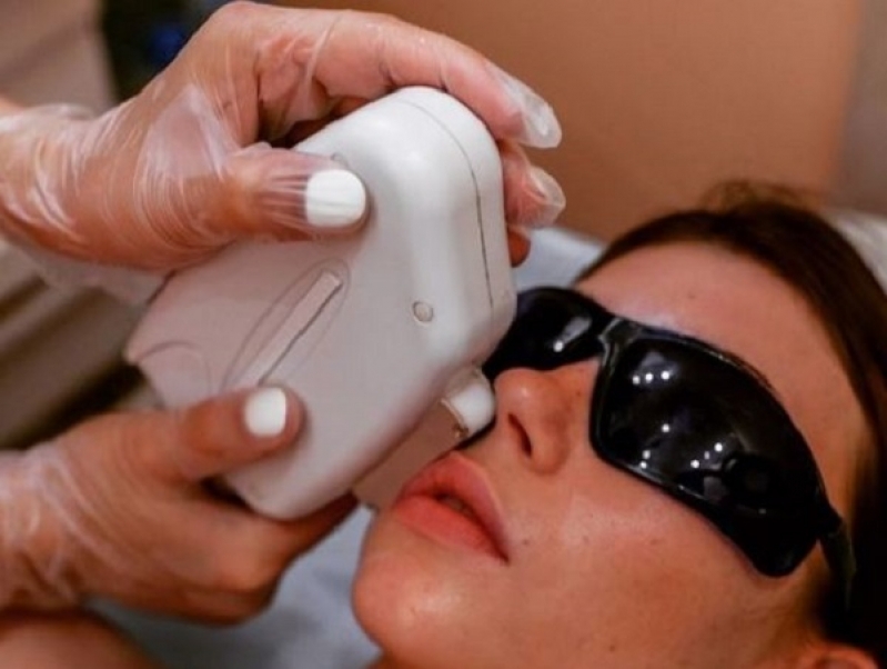 Лазерная эпиляция: особенности процедуры - 2021-03-19 10:27:00 - 2