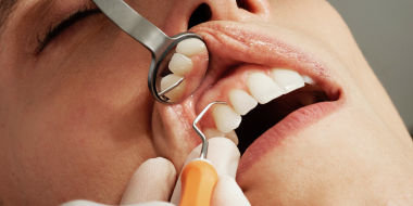 Мужчины чаще женщин боятся стоматологов - 2023-06-28 20:35:00 - 2