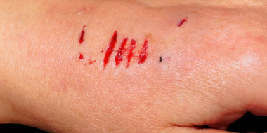 Карантин по бешенству снят в Великолукском районе - 2023-05-26 17:35:00 - 2