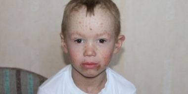 Великолучане собирают деньги на лечение ребенка с редким и тяжелым заболеванием - 2021-06-17 19:00:00 - 2