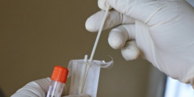 Общественники требуют снизить цены на ПЦР-тестирование в России - 2022-02-27 13:00:00 - 2