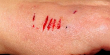 Памятка по предупреждению распространения бешенства - 2021-09-07 10:57:00 - 2